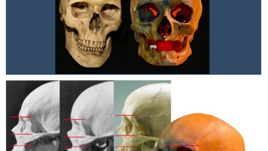 Анатомия человека: голова, шея. Возрастные изменения